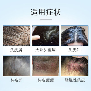 KANGWANG/康王 去头皮屑 去屑止痒洗发水