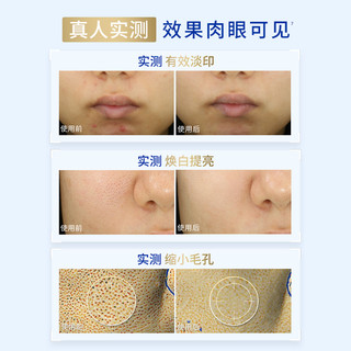 妮维雅630水乳旅行护肤淡斑焕白去黄补水