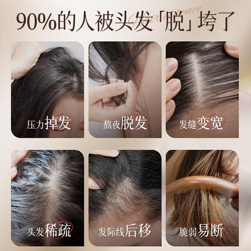临期26.1得嫚媞生发液增发密发精华快速生长发际线头发增长液