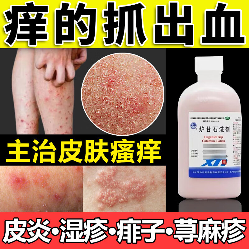 星海 炉甘石洗剂