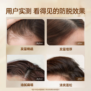 卓蓝雅生姜洗发水防脱头皮精华液固发护发套装控油蓬松去屑止痒 850ml洗发水+50ml精华液