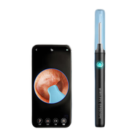 素诺 SUNUO【价】小米有品可视挖耳勺发耳勺工具高清采耳耳屎专业