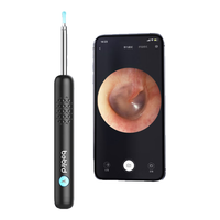 Bebird蜂鸟采耳 智能可视挖耳勺采耳棒掏耳朵高清发光掏耳勺 R1 Ultra 黑色