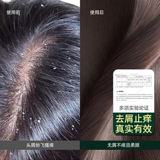 黛熙梦【店】黛熙梦清爽去屑止痒洗发水二硫化硒深层去屑止痒控 家庭3瓶