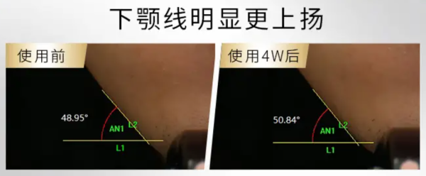 实验室实测背书,前沿成分+硬核数据,奢睿男士抗老不玩虚的!