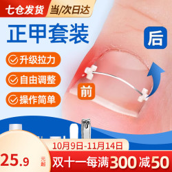 东祝今康甲沟炎矫正器正甲贴指甲贴片嵌甲脚指甲往肉里长脚纠正器脚趾垫 10只丝套装