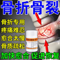 南岛 骨折骨裂恢复的药 骨折钙片骨头断裂剧烈疼痛骨折愈合药骨