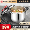 康巴赫 304不锈钢双档复底压力锅 6L 赠汤勺漏勺 22cm