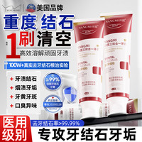 洋觅 YANGMI 去牙结石牙膏抑菌除口臭去黄去渍美白去牙渍去烟渍牙垢清新口气