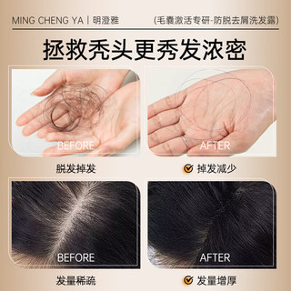  Mcy/明澄雅 防脱育发 生姜洗发水