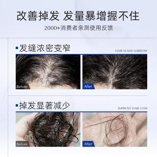  EXPRESSIONS 防掉发 防脱洗发水