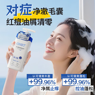  OHBT 去屑止痒控油 洗发水