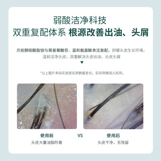 NVH【官·方】nvh洗发水控油蓬松无硅油氨基酸洗发水男女清爽 洗发水+沐浴露*300ml