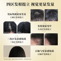  Nature's Gate/天然之扉 控油防断发 洗发水护发素套装  572ml