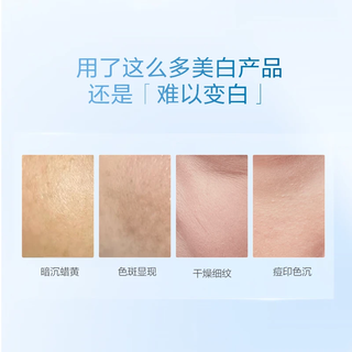 韩束（KanS）白蛮腰水乳美白淡斑护肤品套装补水保湿化妆品全套 【美白淡斑】水80ml*2+乳80ml*2