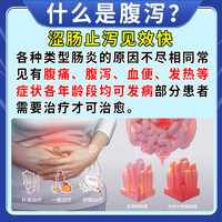 固本益肠片100片国药认证健脾化湿调理脾胃脾虚湿气重止泻脾肾阳虚腹痛益肠润肠通便腹泻药腰酸乏力哪家好 2盒【涩肠止痛】固本益肠片