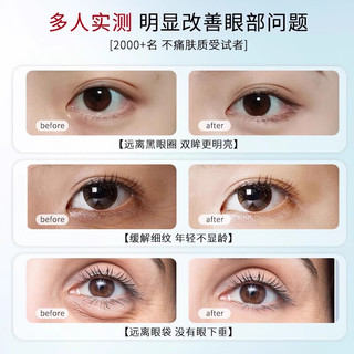 南袖【品质甄选】南袖眼膜眼霜女水润眼周紧致提拉淡化细纹缓解黑眼圈 3盒/30片【周期装】