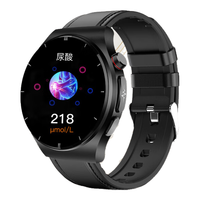  SMART GULL/安智鸥 无创血糖尿酸血脂监测 血糖监测手表+真皮表带  黑色 46mm