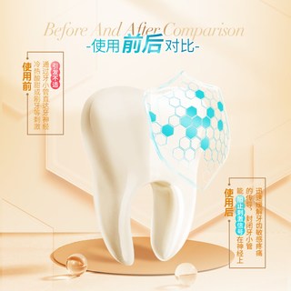  冷酸灵 抗敏感牙釉质密集修护 抗敏牙膏