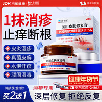 久卜制药 湿疹药膏止痒去根皮炎湿疹皮肤瘙痒癣真菌感染肛门瘙痒汗疱疹 1盒