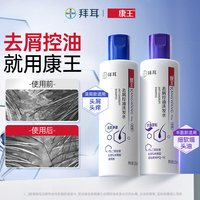 康王复方酮康唑洗剂 205ml*2