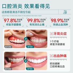 医用漱口水杀菌除口臭消炎牙周炎口腔溃疡牙结石便携一次性小包装