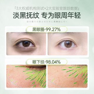  RUYI/儒意 改善黑眼圈眼袋泪沟抗淡化细纹提拉紧致皱纹 眼霜 【巩固装】重度黑眼圈·眼纹90g