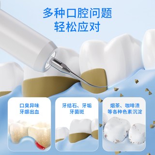  梦艾诺 牙结石清理 超声波洁牙器