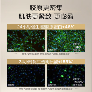  SHISEIDO/资生堂 抗皱淡化眼纹 眼霜  小针管眼霜2ml（二代）