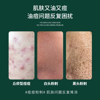 颜伊施 壬二酸焕颜精华霜 20%壬二酸 改善痤疮、粉刺