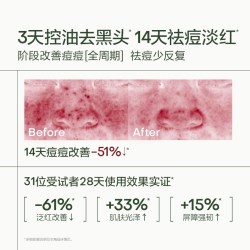 安敏优青蒿祛痘棒次抛精华闭口控油修红修护修复舒缓