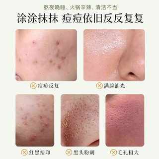  HKH 水杨酸果酸 祛痘精华液