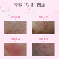 AIREE/安伊妮 舒缓修护保湿 控油祛痘精华乳液