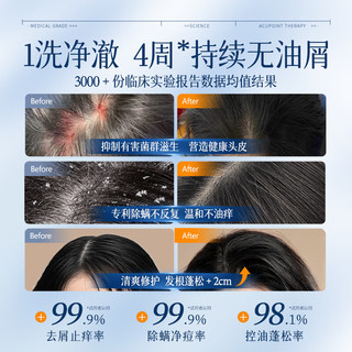  CHUMMATE/初蔓 去屑止痒控油 二硫化硒去屑洗发水