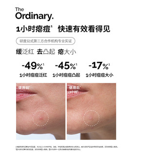  The Ordinary 硫磺粉霜