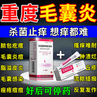 华青 克霉唑乳膏1盒 克林霉素甲硝唑搽剂1盒