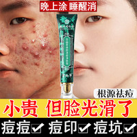 同仁堂 TRT）祛痘膏去痘痘和痘印祛痘印修复淡化痘印痘坑修复青春痘学生20g