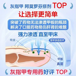楚甲 盐酸阿莫罗芬搽剂