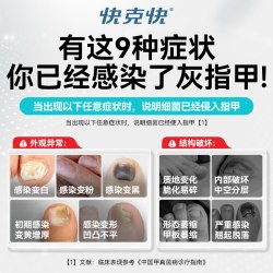 快克快 盐酸阿莫罗芬搽剂