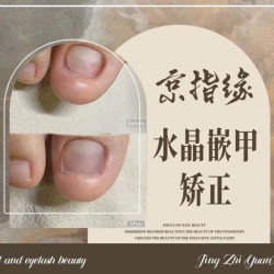 嵌甲卷甲上翘甲肉包甲残甲单指起步价