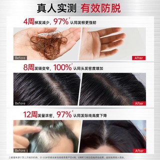 CABELO/卡蓓诺 头皮防脱精华液