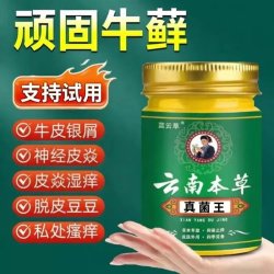云南本草牛藓银皮藓手足皮肤痒止痒膏体藓股藓顽固皮焱湿珍止痒膏