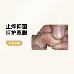 槿致 脚痒脚臭止痒膏脱皮起水泡喷雾剂开裂克星脚汗脚趾缝痒王抑菌神器