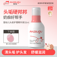 akasugu 婴幼儿头皮护理精华液50ml宝宝去头垢奶痂护理保湿