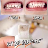 臻宛艾 洁牙擦去牙垢纳米海绵擦祛除牙黑斑牙渍神器口腔护理擦洁牙器清洁