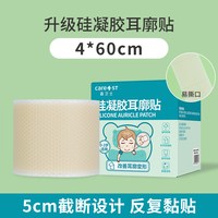 金本士 耳朵矫正器婴儿耳廓固定贴招风耳纠正神器耳撑宝宝垂耳定型硅凝胶