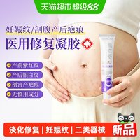 88VIP：可孚 医用硅酮妊娠纹修复凝胶孕妇产后专用油祛疤膏霜20g*2支