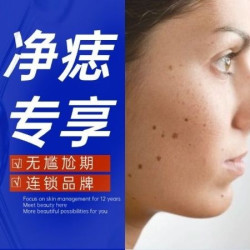 皮肤检测|红痣/蓝痣/肉痣/黑痣/痦痣/小黑痣清洁
