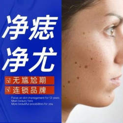 皮肤检测|黑痣/扁平/尤雀斑/脂肪粒丝状/尤/皮赘