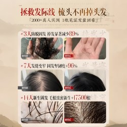 倾龄 侧柏叶生姜洗发水防脱生蓬松控油去屑止痒膏男女官方旗舰店何首乌